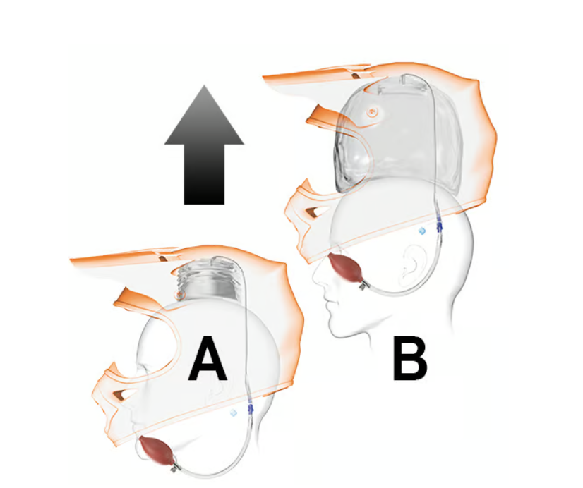 Eject Helmet Removal System - Bladder Kit